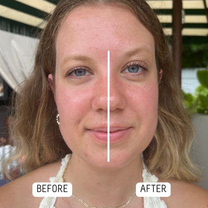 Cryo Toning Tools — Beautology Lab